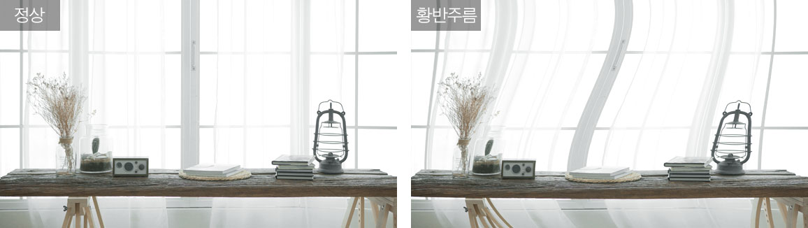 정상일때의 눈으로보이는 이미지와 황반주름일때 눈으로보이는 이미지